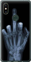 Чохол на Xiaomi Mi Mix 2s Рука через рентген "1007u-1438-851"
