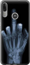 Чохол на Motorola Moto E6 Plus Рука через рентген "1007u-1780-851"