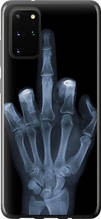 Чохол на Samsung Galaxy S20 Plus Рука через рентген "1007u-1822-851"
