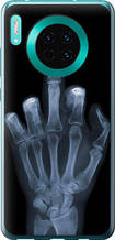 Чохол на Huawei Mate 30 Рука через рентген "1007u-1773-851"