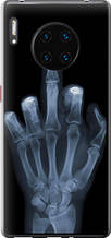 Чохол на Huawei Mate 30 Pro Рука через рентген "1007u-1796-851"