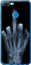Чохол на Huawei Honor 9i Рука через рентген "1007u-1853-851"