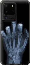 Чохол на Samsung Galaxy S20 Ultra Рука через рентген "1007u-1831-851"