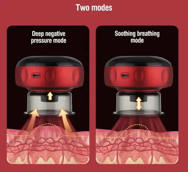 Вакуумний юСБ банковий масаж антицелюлітний AND XL-1052, фото 1