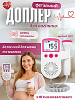 Доплер фетальний ультразвуковий для вагітних 3 МГц з РК-дисплеєм, монітор серцевого ритму плода, JSL-T501-White/Roze