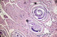 Трихінельоз у диких кабанів