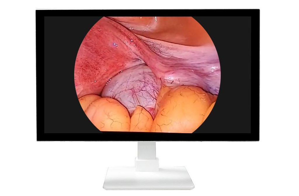 4K Монітор ЛОКЕМЕД, 55 дюймів, фото 1