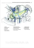 Атлас хірургічних операцій Золлінгера 2-е видання 2024 рік Кристофер Эллісон Атлас по хірургії, фото 8