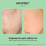 Пілінг-сироватка зі спікулами для обличчя MEDIPEEL Phyto Cica Nol B5 3000 Shot 50 г, фото 6