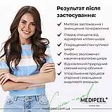 Пілінг-сироватка зі спікулами для обличчя MEDIPEEL Phyto Cica Nol B5 3000 Shot 50 г, фото 7