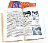 Хачкурузов Ц. Р. Ультразвукове дослідження при вагітності раннього терміну 9-е изд 2021 рік, фото 3