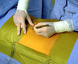 Антимікробна плівка для хірургічного поля 3M™ Ioban™ 2, 10×20 см, стерильна, 1 шт, фото 8