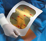 Антимікробна плівка для хірургічного поля 3M™ Ioban™ 2, 10×20 см, стерильна, 1 шт, фото 9