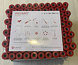 Пробірка 6 мл червона кришка з активатором згортання, фото 3