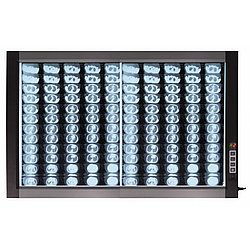 Світлодіодний медичний негатоскоп WL-2D