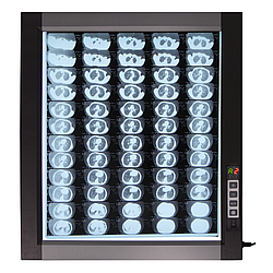 Світлодіодний медичний негатоскоп WL-1D