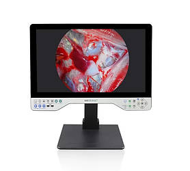 Ендоскопічна відеосистема TUYOU 24LSD1B 1080Р (24 дюйми, жорстка, Все в одному)