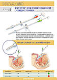 КАТЕТЕР ДЛЯ ПУНКЦІЙНОЇ ЕПІЦІСТОСТОМІЇ, фото 2