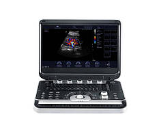 Портативний УЗД апарат Finus 50 Focus&Fusion Медапаратура