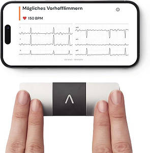 AliveCor KardiaMobile 6L - Електрокардіограф, ЕКГ-монітор сумісний зі смартфоном, виявляє фібриляцію передсердь лише за 30 секунд