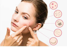 Проблемна шкіра, дерматологічні захворювання