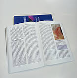 Трюб Р. М. Складний пацієнт трихолога. Керівництво по ефективному лікуванню алопецій та супутніх захворювань, фото 2