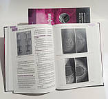 Основи мамографії С. Уильямс, К. Тейлор, С. Кэмпбелл 2024 рік 200 иллюстрацій, фото 7