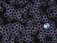 Мікроскопія в темному полі. Як обрати мікроскоп?