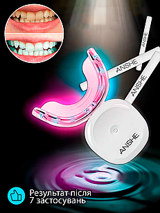 Набір для відбілювання зубів ANSHE - WHITE