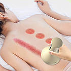 Масажер антицелюлітний, з підігрівом + Подарунок Фітнес резинки 5шт / Акумуляторний масажер для тіла / Масажер від целюліту, фото 5