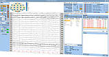 TruScan EEG - професійна система електроенцефалографії, фото 7