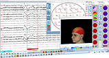 TruScan EEG - професійна система електроенцефалографії, фото 9