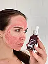 Кислотна сироватка-пілінг для обличчя HOLLYSKIN Glycolic Acid 30 мл, фото 4