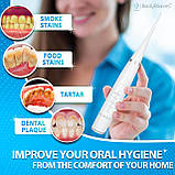 Засіб для видалення зубного нальоту для зубів 5 швидкостей | Засіб для видалення зубного каменю| інструменти для чищення зубів, фото 4