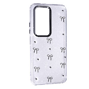 Чохол Glue Case Hit для Xiaomi Redmi 15 (EUROPE) 171 mm Bows