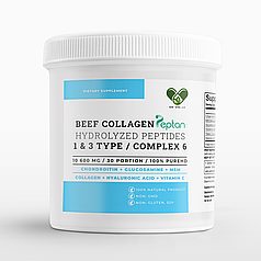 Колаген для суглобів глюкозамін хондроїтин мсм гіалуронова кислота в порошку 5000 Envie Lab