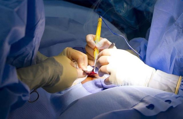 Застосування електрохірургічного коагулятора Застосування електрохірургічного коагулятора в операційній