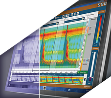 Імпедансна манометрія високої роздільної здатності HRiM