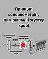 Принцип сонореометрії у вимірюванні згустку крові