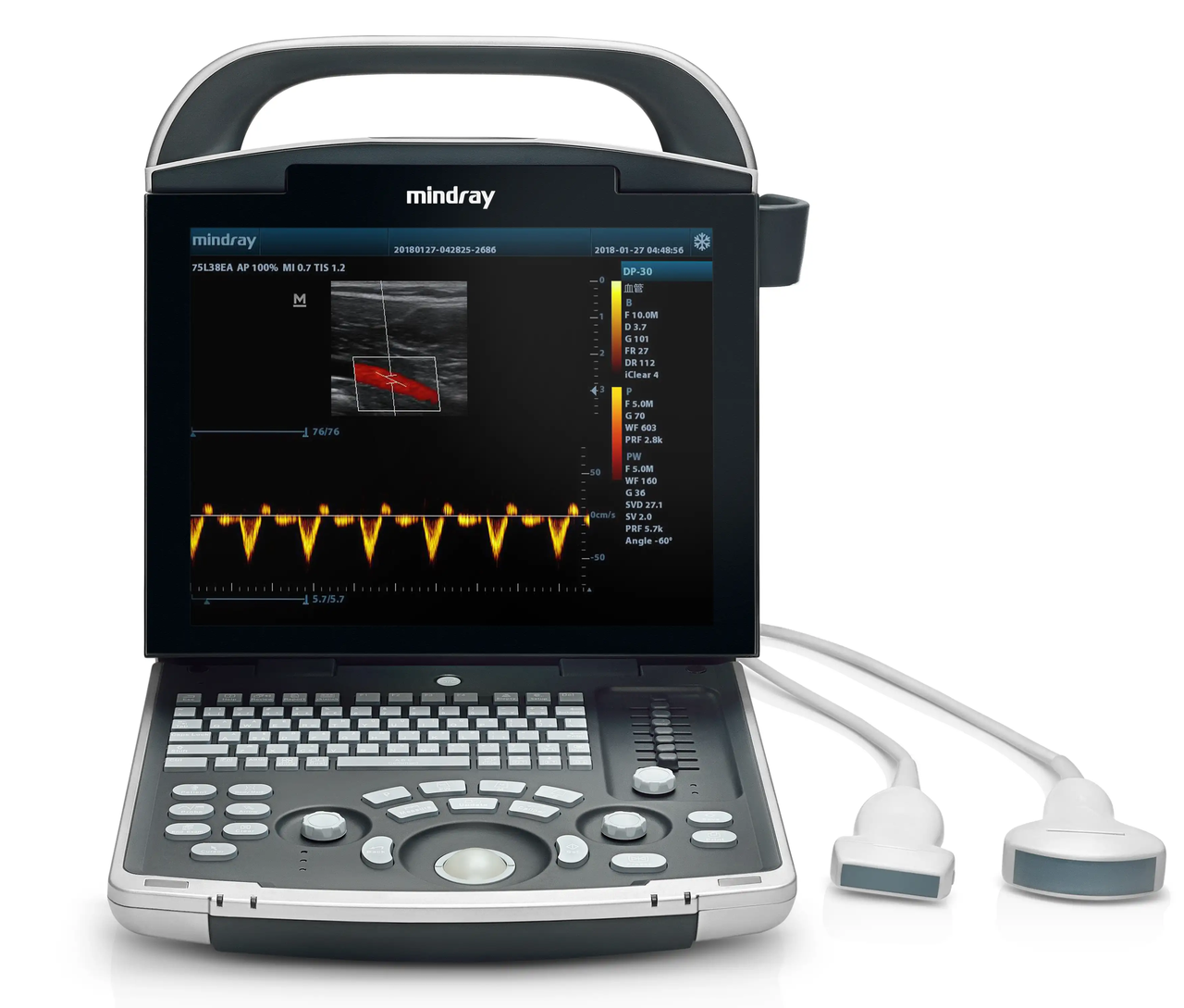 Система ультразвукова діагностична Mindray DP-30 з 2-ма датчиками, конвексним та лінійним