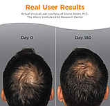 Вітаміни для волосся чоловічі Vivical Man 60 таб. США для росту волосся, густе та повне волосся., фото 3