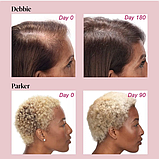 Вітаміни проти випадання Vivical Hair Growth 60 таб. США волосся вітаміни для росту волосся, вітамін для волосся, фото 5