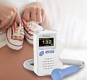 Фетальные доплеры