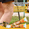 Мазь проти варикозного розширення вен Sumifun з бджолиною отрутою (Sumifun Bee Venom Varicose Vein Ointment)., фото 2