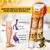 Мазь проти варикозного розширення вен Sumifun з бджолиною отрутою (Sumifun Bee Venom Varicose Vein Ointment)., фото 3