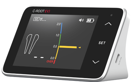 Апекслокатори