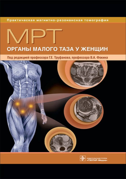 

Труфанова МРТ. Органы малого таза у женщин. Руководство