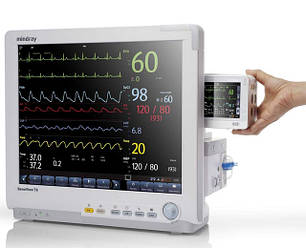 Монітори пацієнта