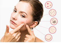 Проблемна шкіра, дерматологічні захворювання