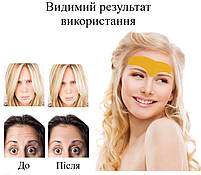 Гелеві патчі для чола та міжбрівної зони від зморшок з колагеном і центелою азіатською 10 шт 29592, фото 7